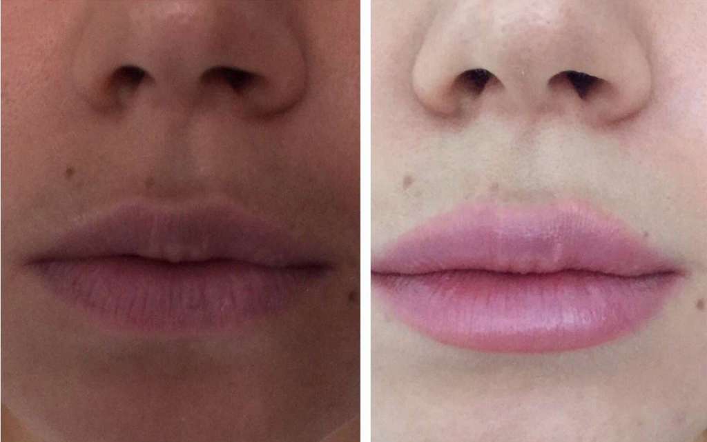 Lyudmila Yurlova Dr. Mozart, Odessa COSMETOLOGY