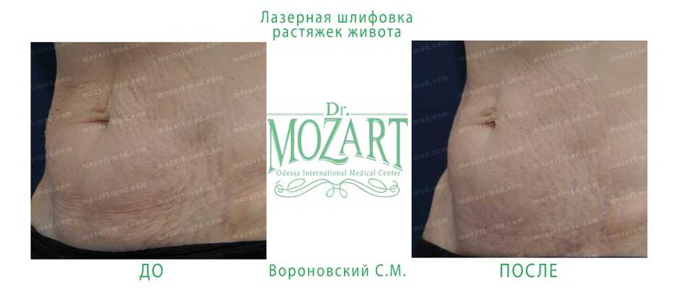 Dr. Mozart Medical Center, Odessa