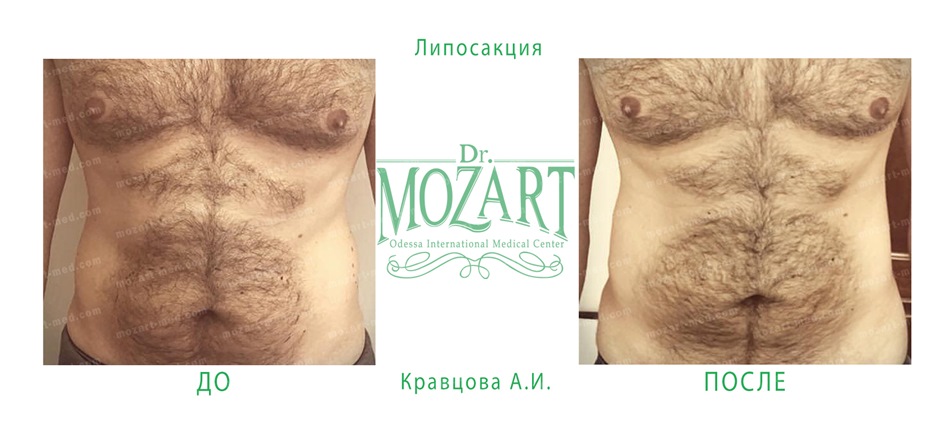 Dr. Mozart, Odessa International Medical Center