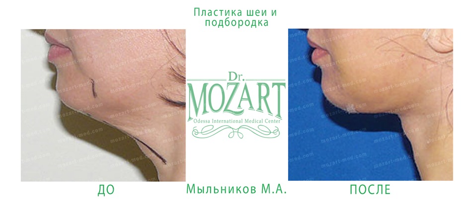 dr mozart medical center odessa ua
